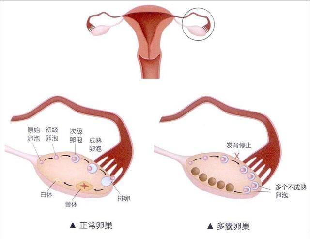 性激素六项检查 性激素六项主要是查什么