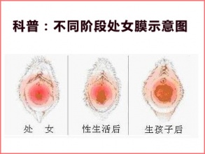 第一次没见红是怎么回事 女性性功能下降的症状