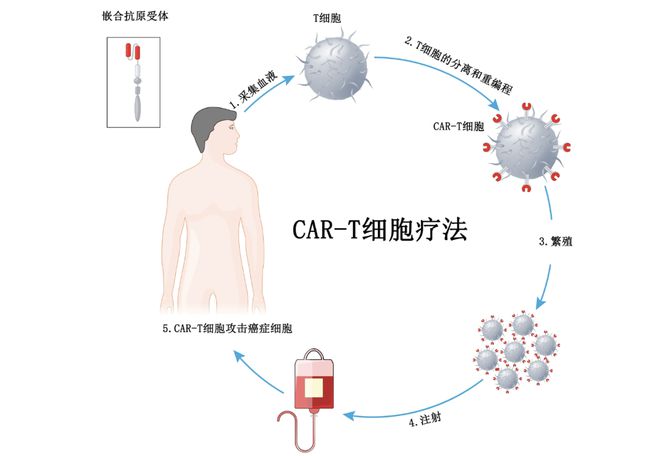 细胞免疫疗法是什么 细胞免疫疗法有效果吗