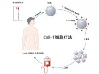 细胞免疫疗法是什么 细胞免疫疗法有效果吗